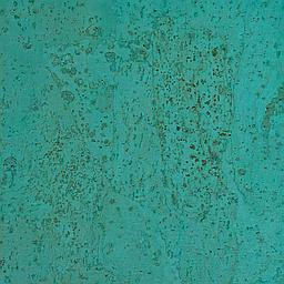 Turquoise - Corcho - Barriga